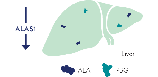 Image of liver with decreased ALAS1 and less ALA and PBG