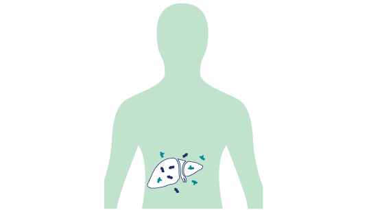 Image of body with less ALA and PBG in the body and liver