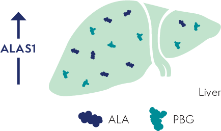 Image of liver with icons of overproduced ALA and PBG